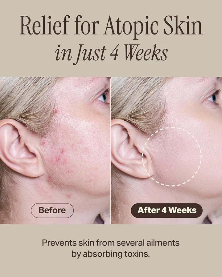 Relief Mud Mask - Celeb's Choice Mask